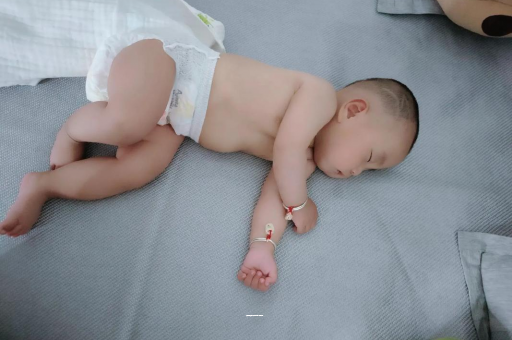 偃师宝宝上火有眼屎